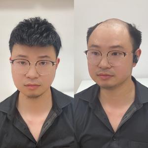 重生假发头像